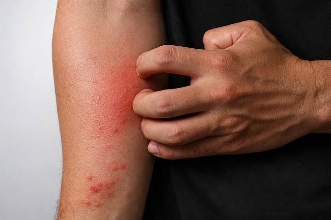 Alamomin Farko na Cutar HIV da Ya Kamata a Sani